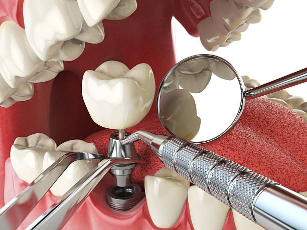 Best Chipped Tooth Repair Near Me  in Shawneeland, VA
